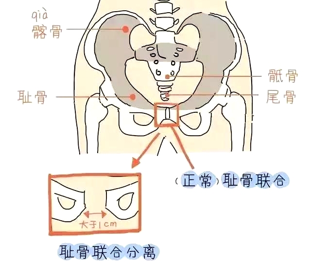 盆底肌康復(fù)治療儀，產(chǎn)后媽媽不再擔(dān)心