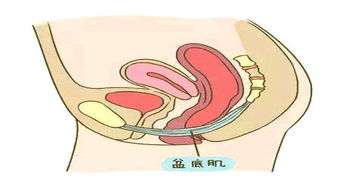 盆底肌康復(fù)治療儀，如何讓盆底肌康復(fù)評估報(bào)告更可靠