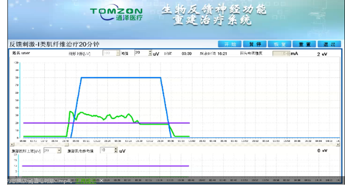 盆底康復(fù)治療怎么做？盆底康復(fù)治療肌電生物反饋治療儀的機理是什么？