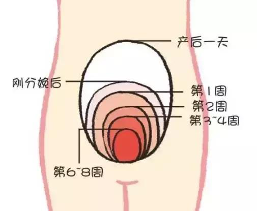 產后康復，什么叫子宮復舊不良？