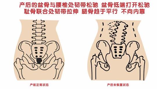 上百家產(chǎn)后修復(fù)中心店家告訴您產(chǎn)后盆底肌怎么修復(fù)