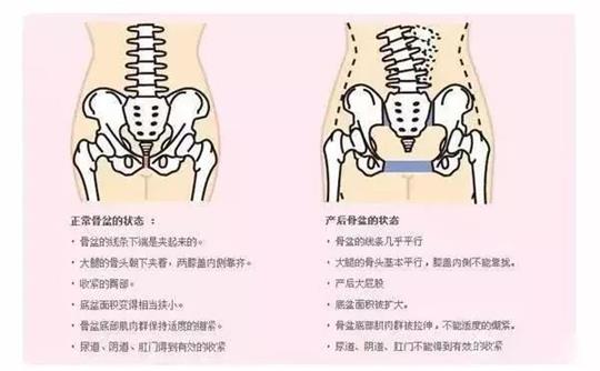 產(chǎn)后修復(fù)治療儀器對于腹直肌修復(fù)有效果嗎？