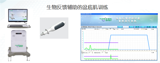 產(chǎn)后修復(fù)|盆底肌肉功能電刺激有什么作用？生物反饋呢？