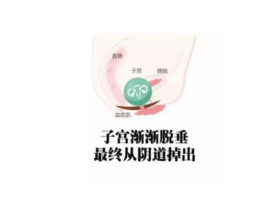 生殖恢復儀又是怎么幫助二胎寶媽恢復產(chǎn)前迷人身材