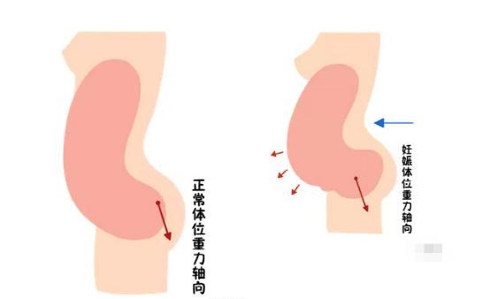 盆底恢復(fù)是否可以使用儀器？