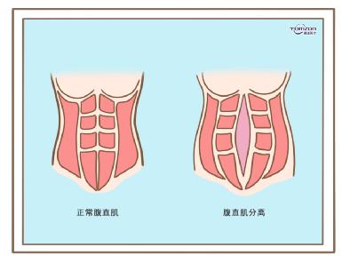 盆底康復(fù)治療儀效果到底怎么樣？