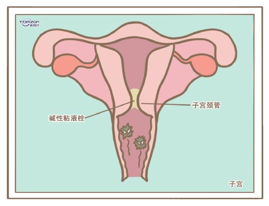 盆底康復(fù)治療儀.jpg